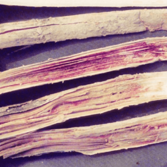 Fusarium