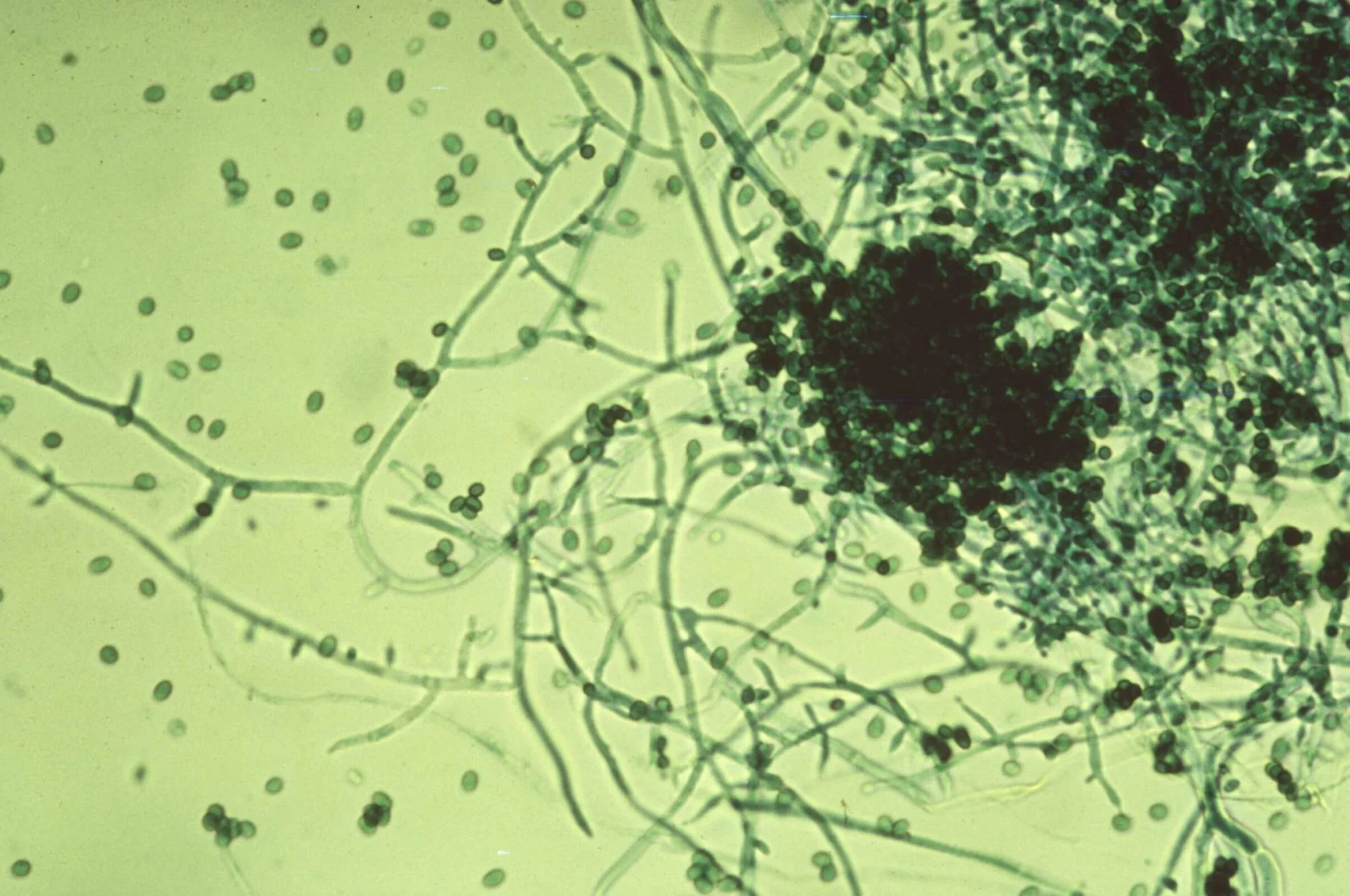 Trichoderma: un aliado natural contra las enfermedades de las plantas